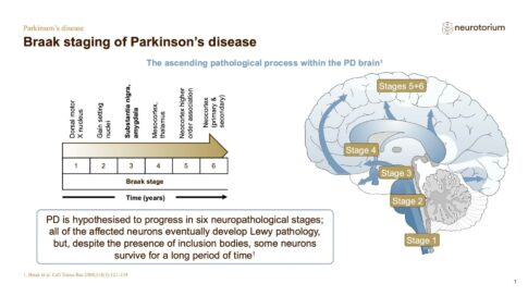 Parkinsons Disease – Neurobiology and Aetiology – slide 12